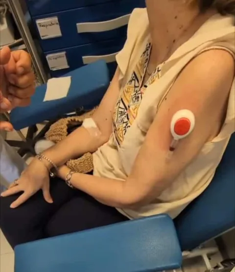 Imagen de la noticia: IBIMA prueba un análisis de sangre capilar para cáncer colorrectal